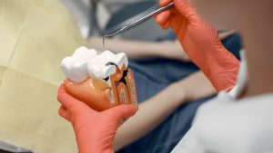 ایمپلنت دندان اقساطی
